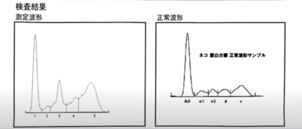 蛋白分画の検査結果