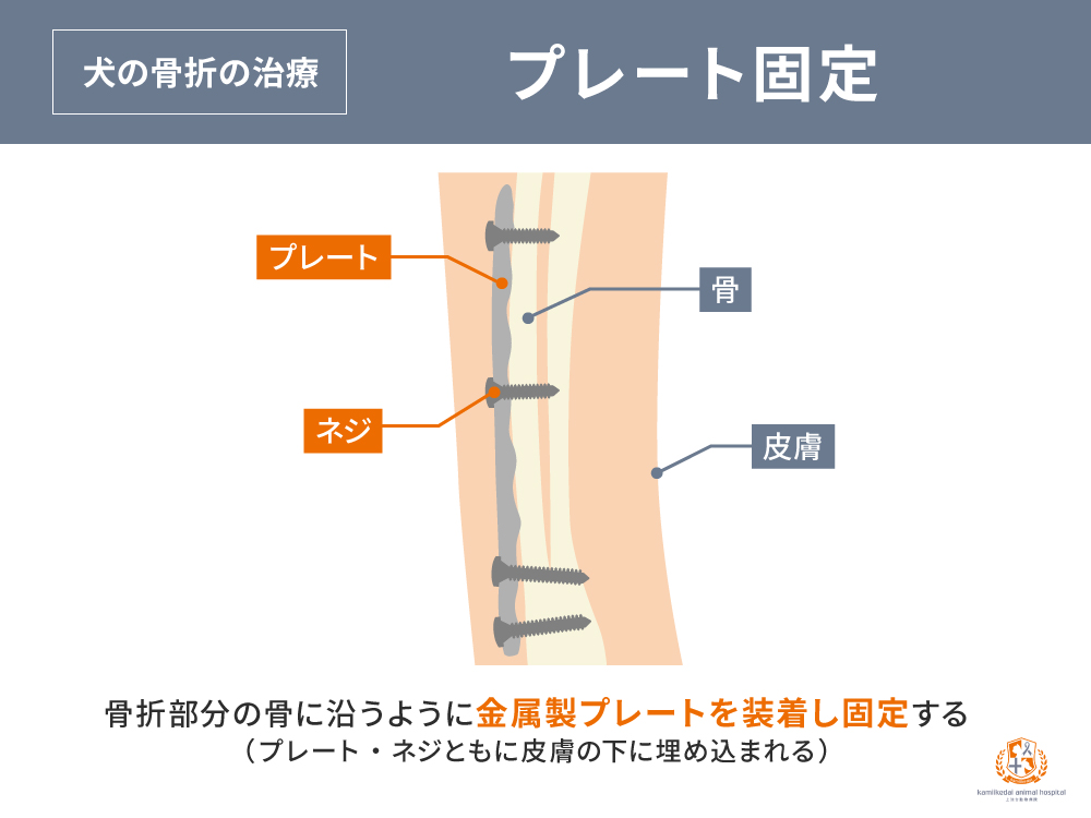 犬の骨折治療　プレート固定